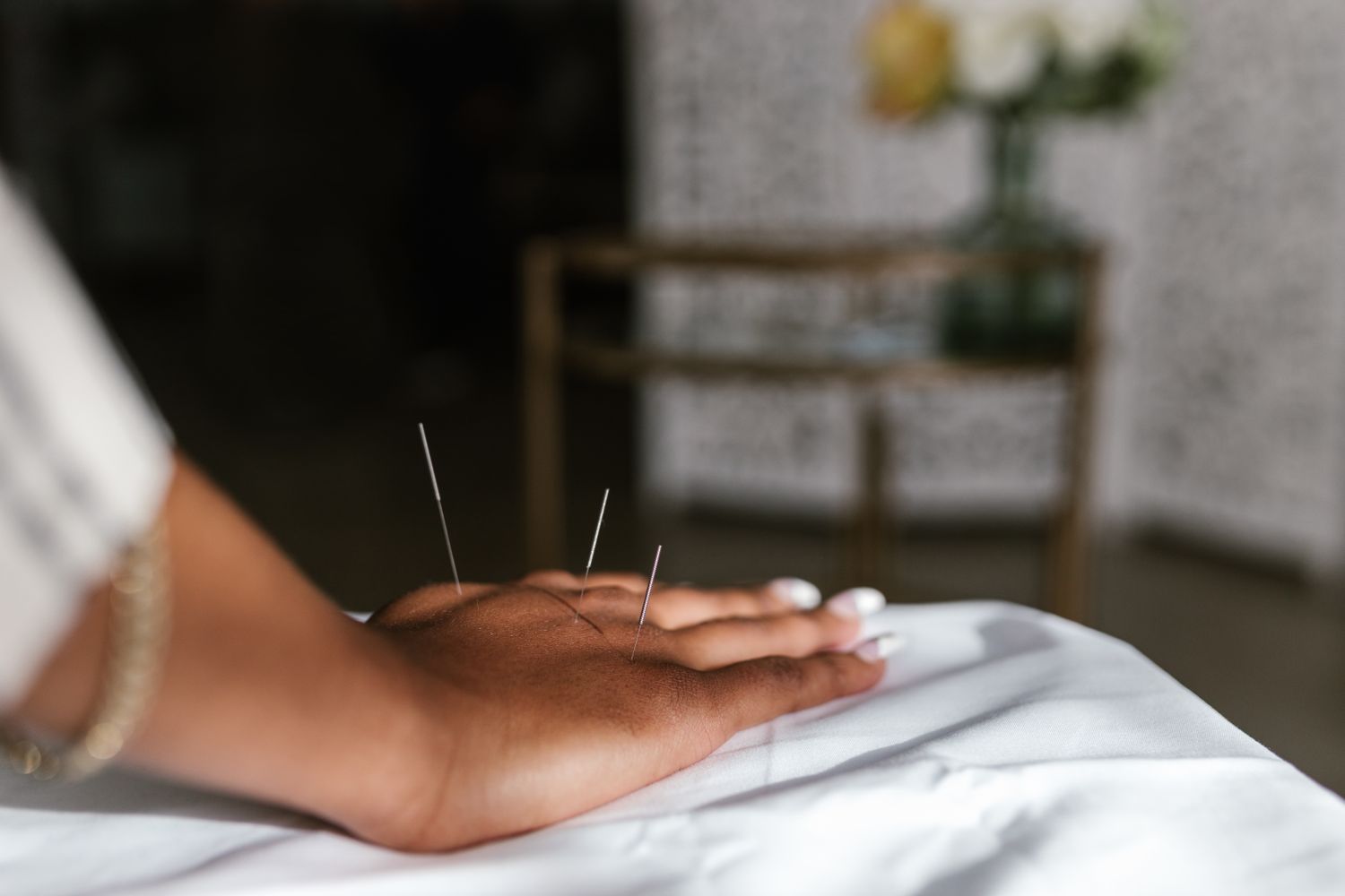 Stimulation de points, approche dérivée de l'acupuncture